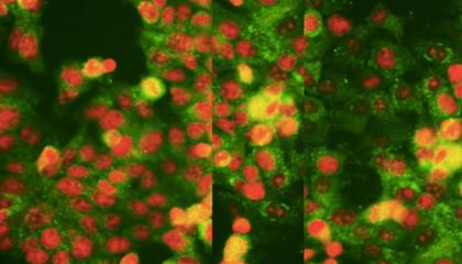 cancer research